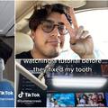 Muškarac se šokirao tijekom posjeta zubaru: 'Na YouTubeu je tražio upute kako popraviti zub'