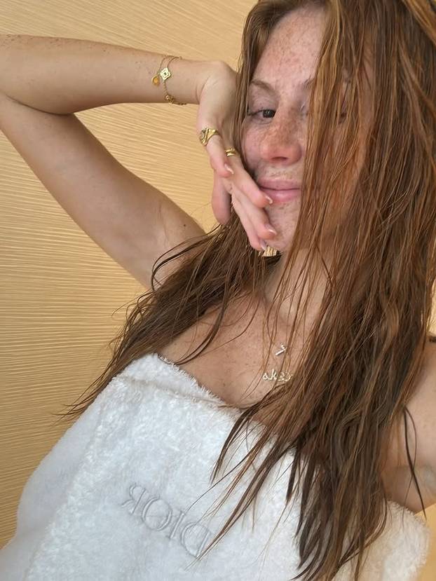 FOTO Posebna ljepota: Milijuni ljudi obožavaju njezine pjegice