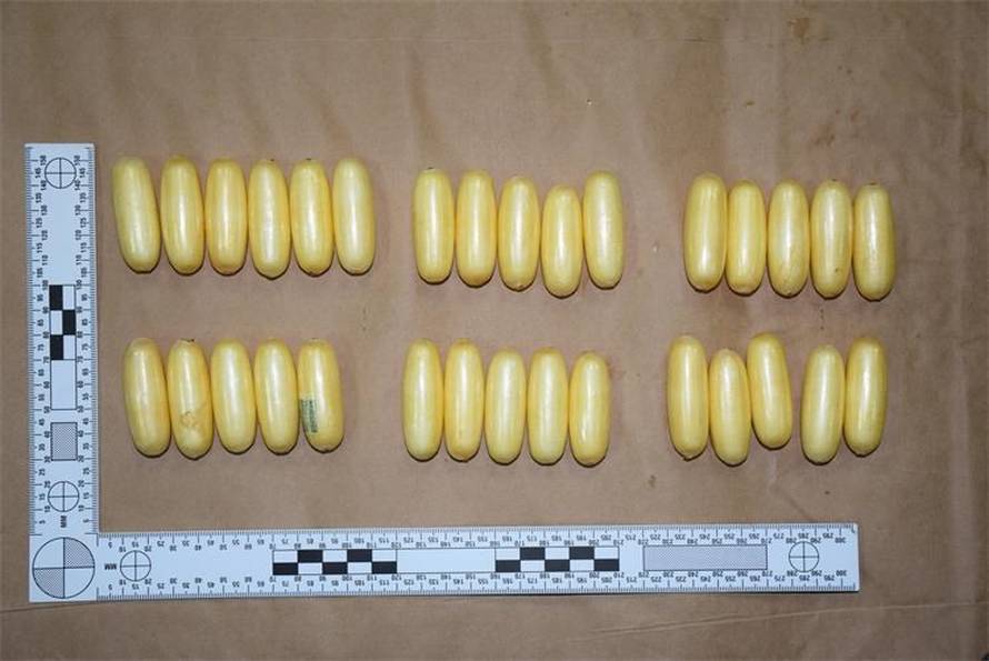 FOTO Ovo je uhićena brazilska mula koja je gutala kapsule s drogom. Neke su ranije 'ispale'