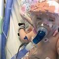 Beba heroj: Nakon operacije na srcu bori se s korona virusom