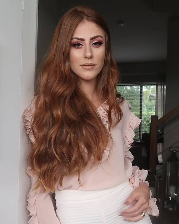 FOTO Posebna ljepota: Milijuni ljudi obožavaju njezine pjegice