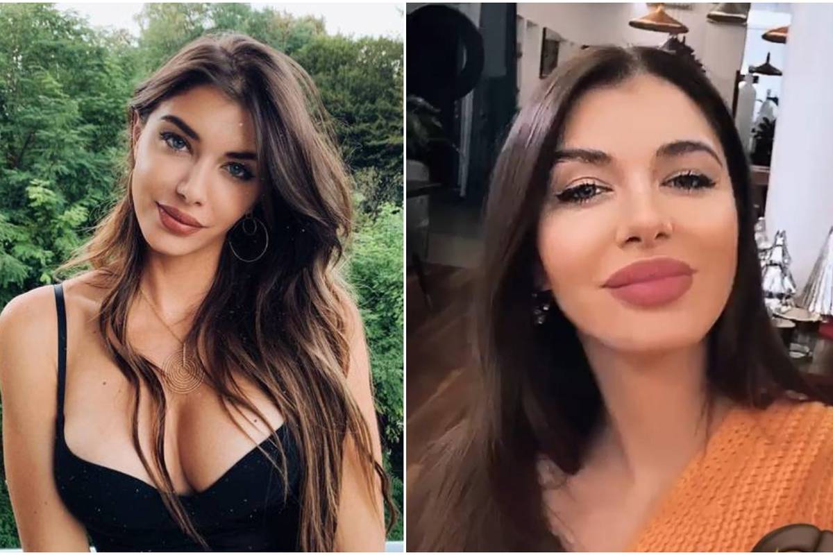Iva Šarić iznenadila izgledom: Nije odoljela povećanju usana?