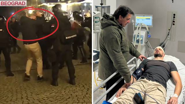 Srpski ministar u bolnici obišao ozlijeđenog policajca, na snimci se vidi da ga udara - kolega!
