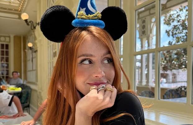 FOTO Posebna ljepota: Milijuni ljudi obožavaju njezine pjegice