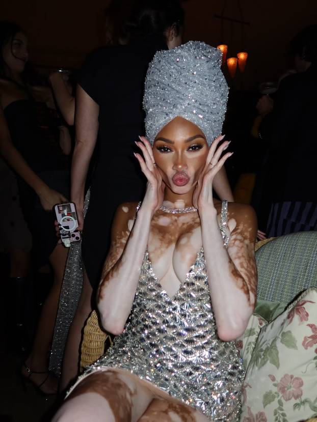 FOTO Rugali su joj se zbog bolesti, a danas je obožavaju zbog jedinstvenog izgleda