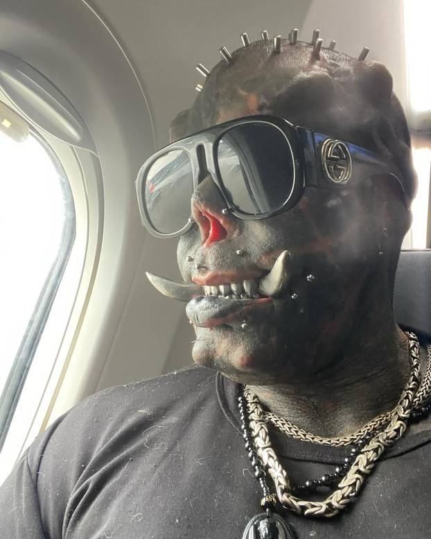 FOTO Uznemirujuće! Uklonila je čak i vrh nosa, a evo kako je izgledala: Šteta, ljepotica si bila