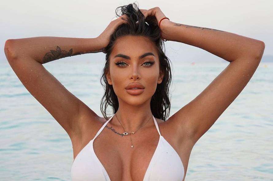 Hana Rodić prije svih operacija izgledala je potpuno drukčije: Evo koje je sve korekcije radila