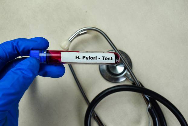 Concept of H. Pylori - Test with blood sample. Healthcare or medical concept