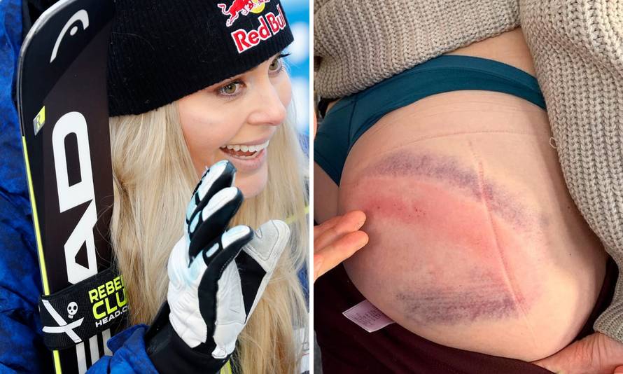 Lindsey Vonn: Tko zna kakve će boje moja guza biti sutra...