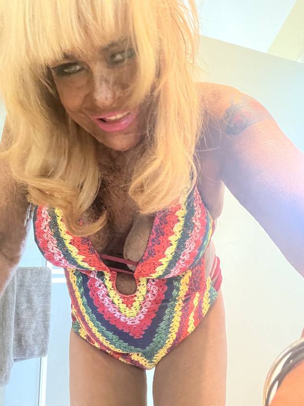 FOTO Ovisna je o solariju. Tamo je vodila i svoju 5-godišnju kćer. 'Kvarcala sam se svaki dan!'