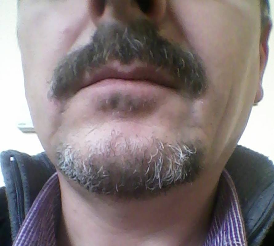 Movember: Pogledajte galeriju brkova koji puštaju čitatelji