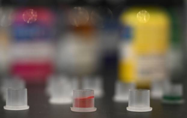 Zagreb: Izložba "Moja koža, kultura tetoviranja" u Etnografskom muzeju