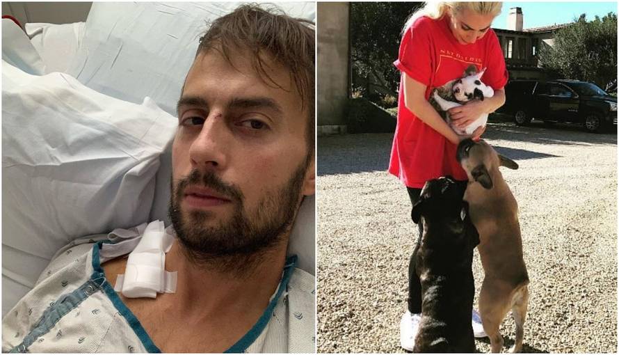 Šetač pasa Lady Gage: 'Život mi je izgubio svrhu nakon napada'