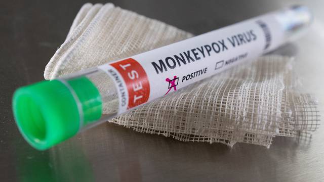 FILE PHOTO: Illustration shows test tube labelled "Monkeypox virus positive\