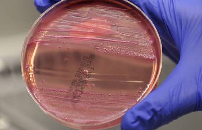 Egipat odbacio odgovornost za 'zaraženost' sjemena E.coli