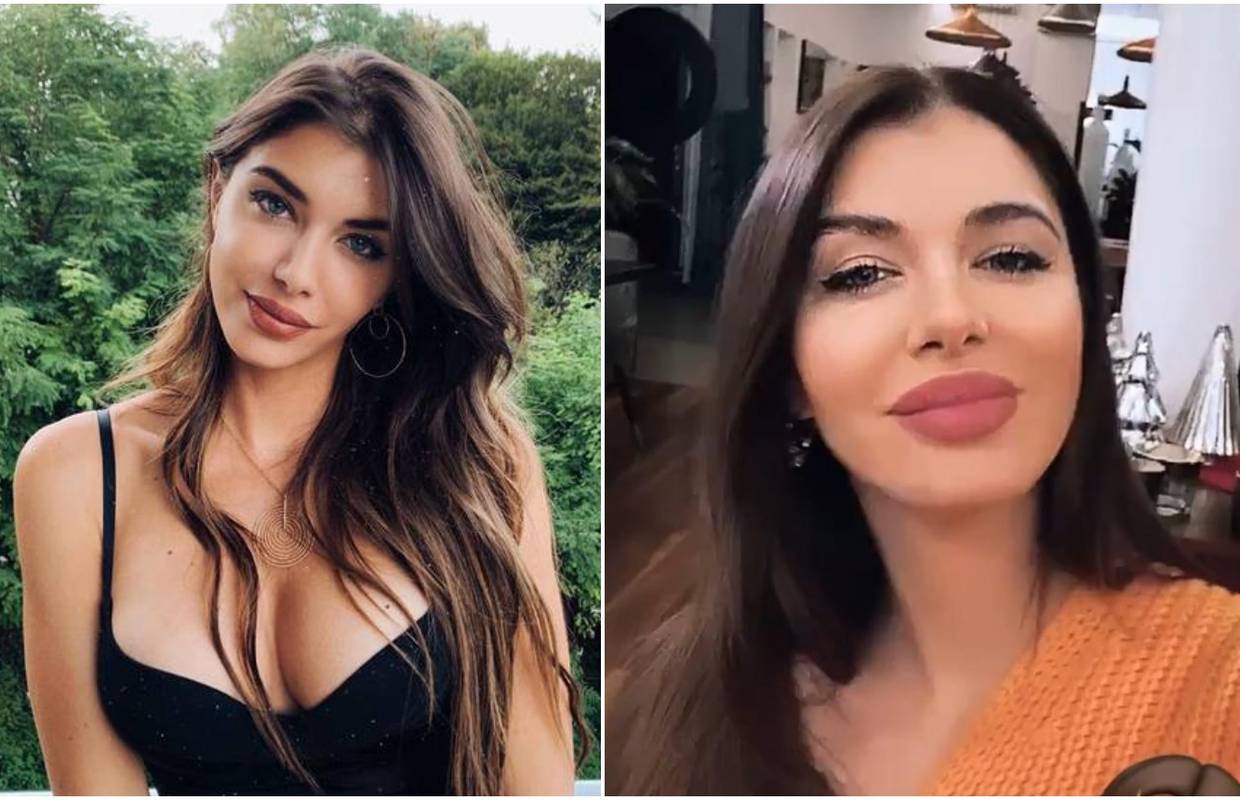 Iva Šarić iznenadila izgledom: Nije odoljela povećanju usana?