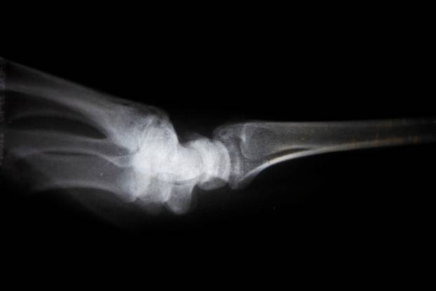 Medicinski testovi koje trebate češće raditi nakon 60. godine