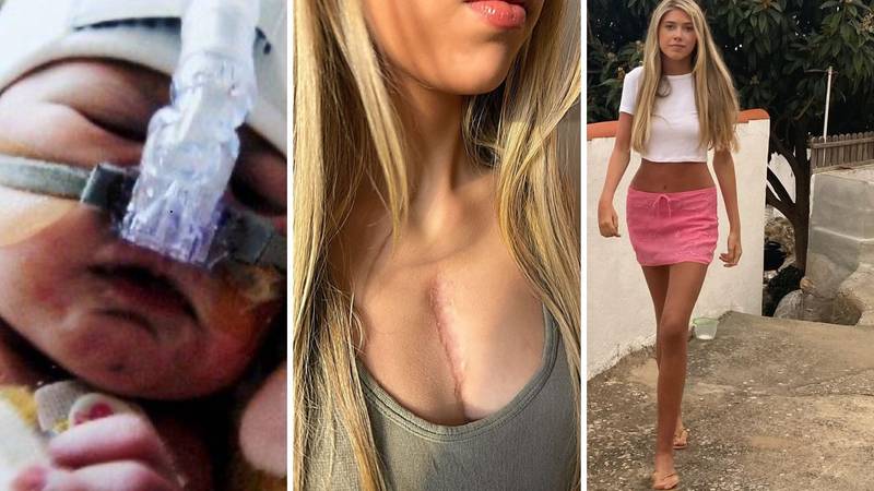 MEDICINSKO ČUDO 'Preživjela sam 5 operacija srca i jednu kralježnice. Viša sam 7,5 cm'