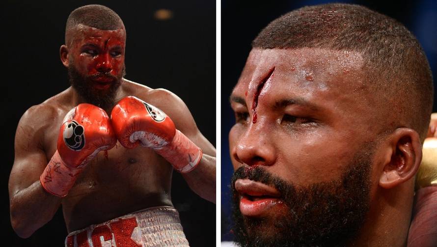 Ružna ozljeda boksača: Puklo mu čelo, krvi je bilo i oko ringa