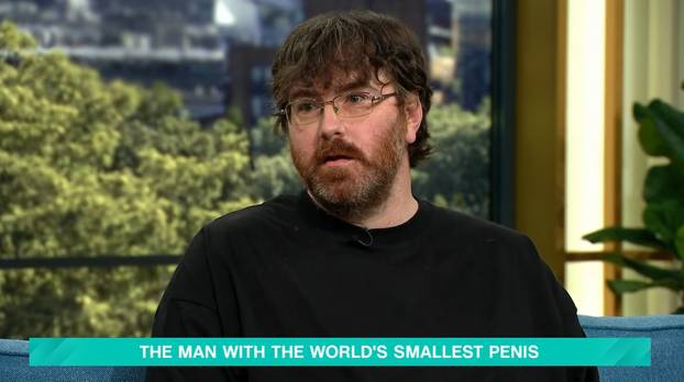 Man with world's smallest penis