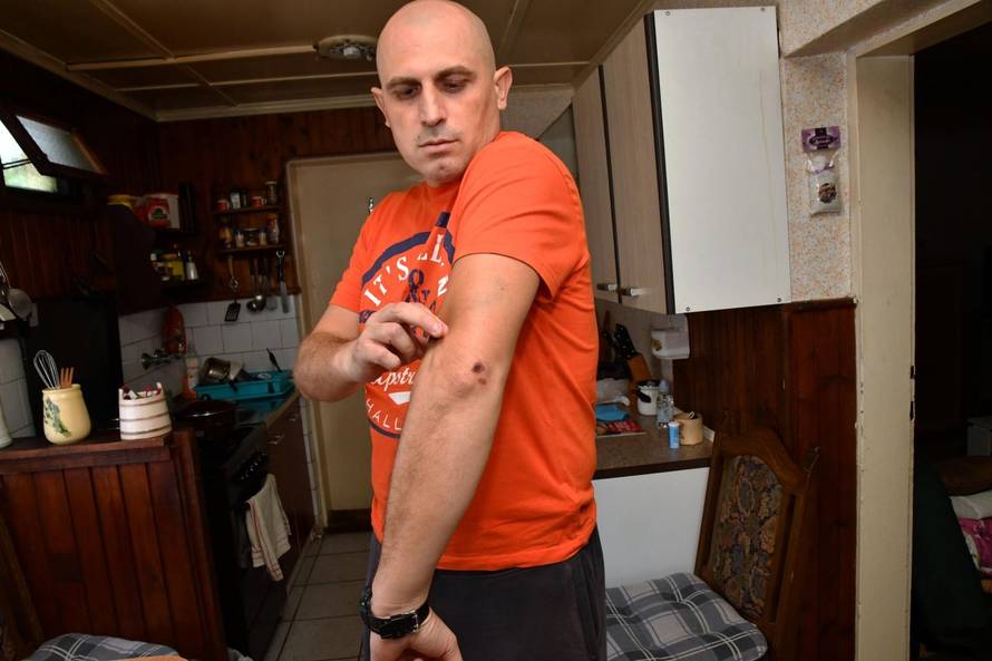 Osumnjičenog zaštitara pustili: 'Udarali su me svuda po tijelu'