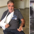 Umirovljenika kod Pule tukao i vojnik: Mlatili su me stolicama