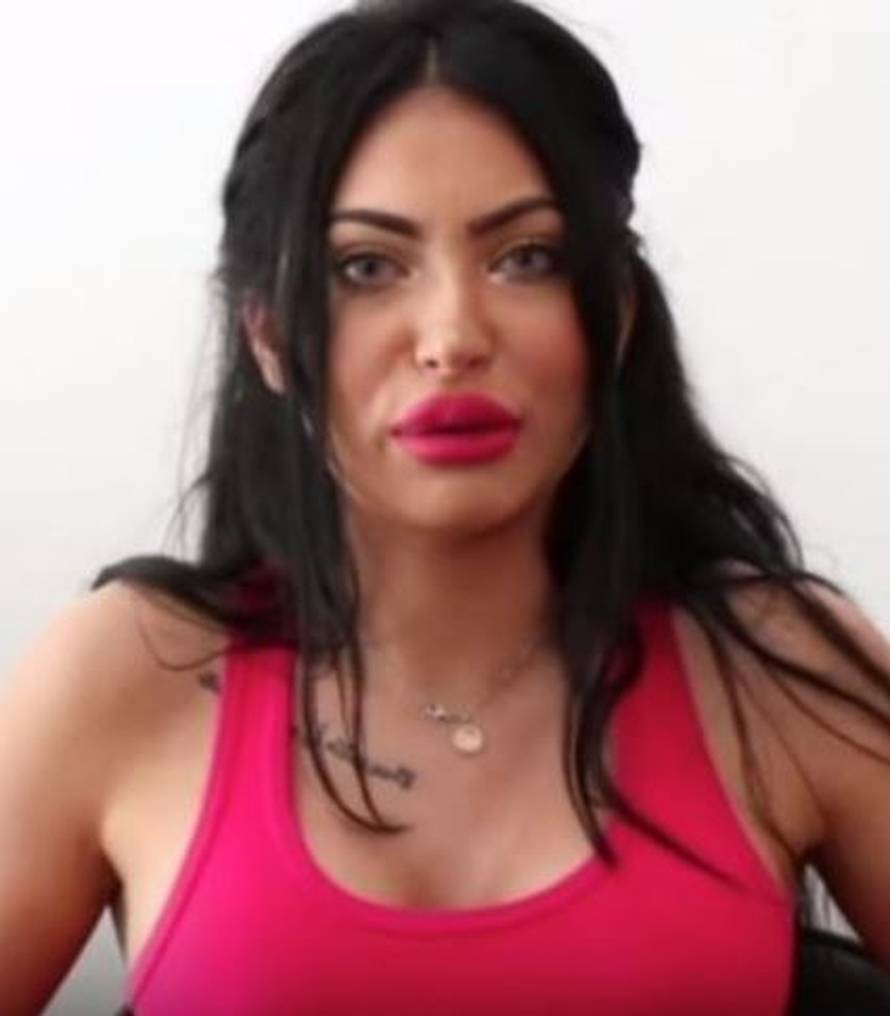 Hana Rodić prije svih operacija izgledala je potpuno drukčije: Evo koje je sve korekcije radila