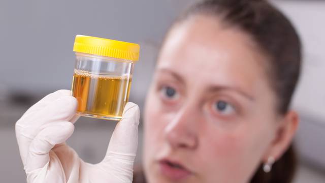 Boja urina i hidracija: Test kako znati pijete li dosta vode ili ne
