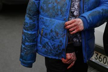 An iniured person walks outside Sennaya Ploshchad metro station following explosions in two train carriages at metro stations in St. Petersburg