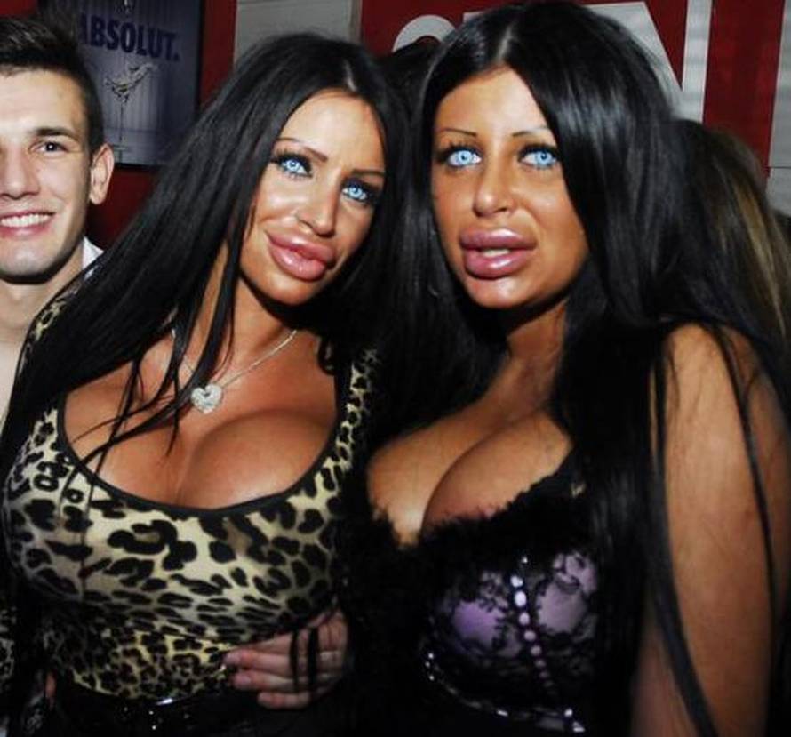 Sjećate li se srbijanske kraljice 'plastike'? Izvadila je silikone...