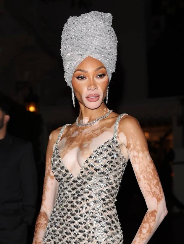 FOTO Rugali su joj se zbog bolesti, a danas je obožavaju zbog jedinstvenog izgleda