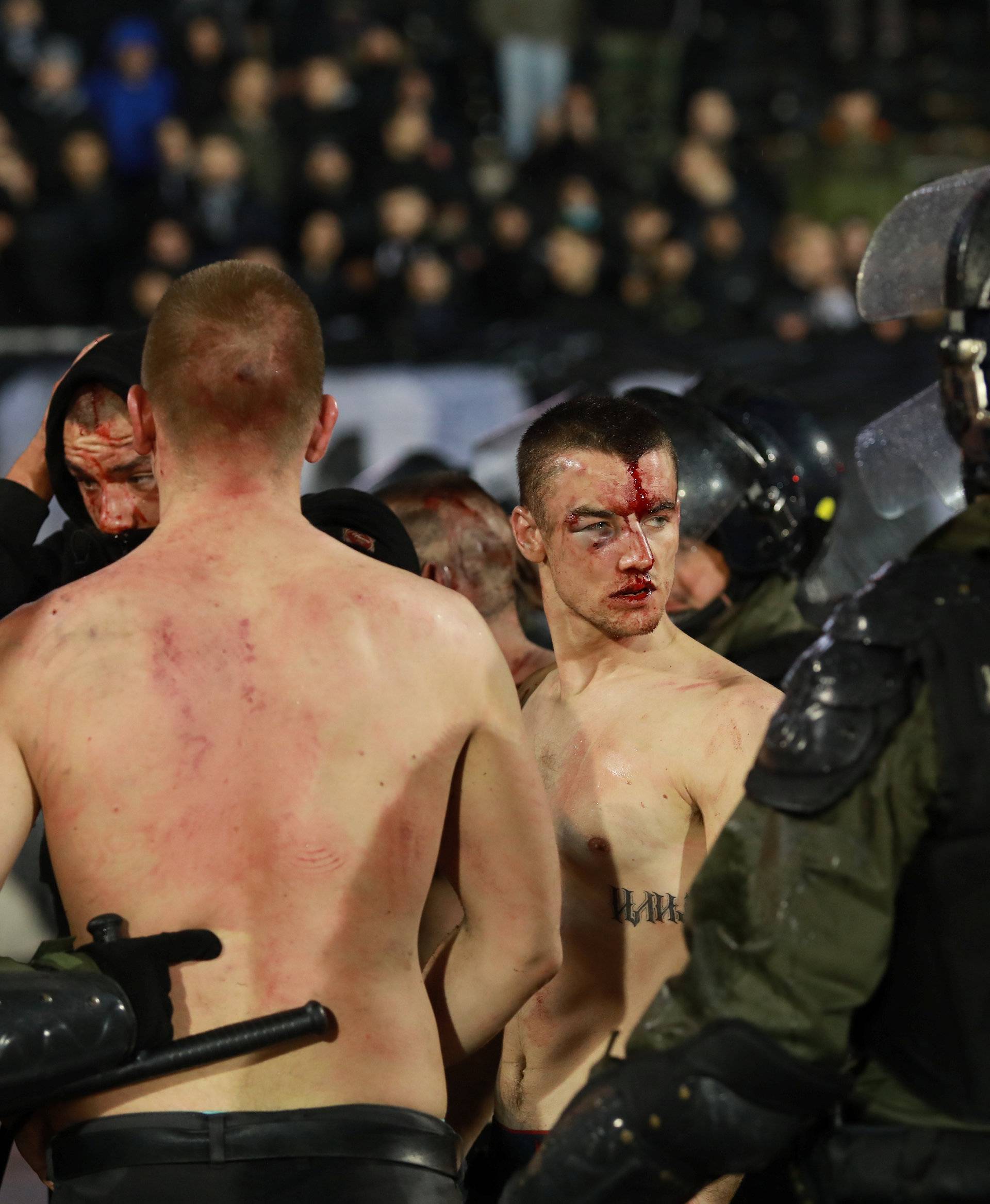 Police escort the soccer fans injured during the fights at a match between Red Star and Partizan in Belgrade