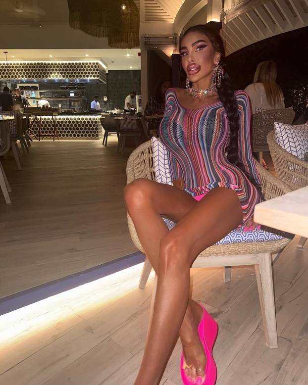 FOTO Potrošila više od 100 tisuća eura kako bi izgledala kao 'ljudska barbika' - Liječnici zgroženi