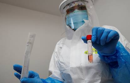 Slovenija: Testirali 715 ljudi, njih pet zaraženo korona virusom...