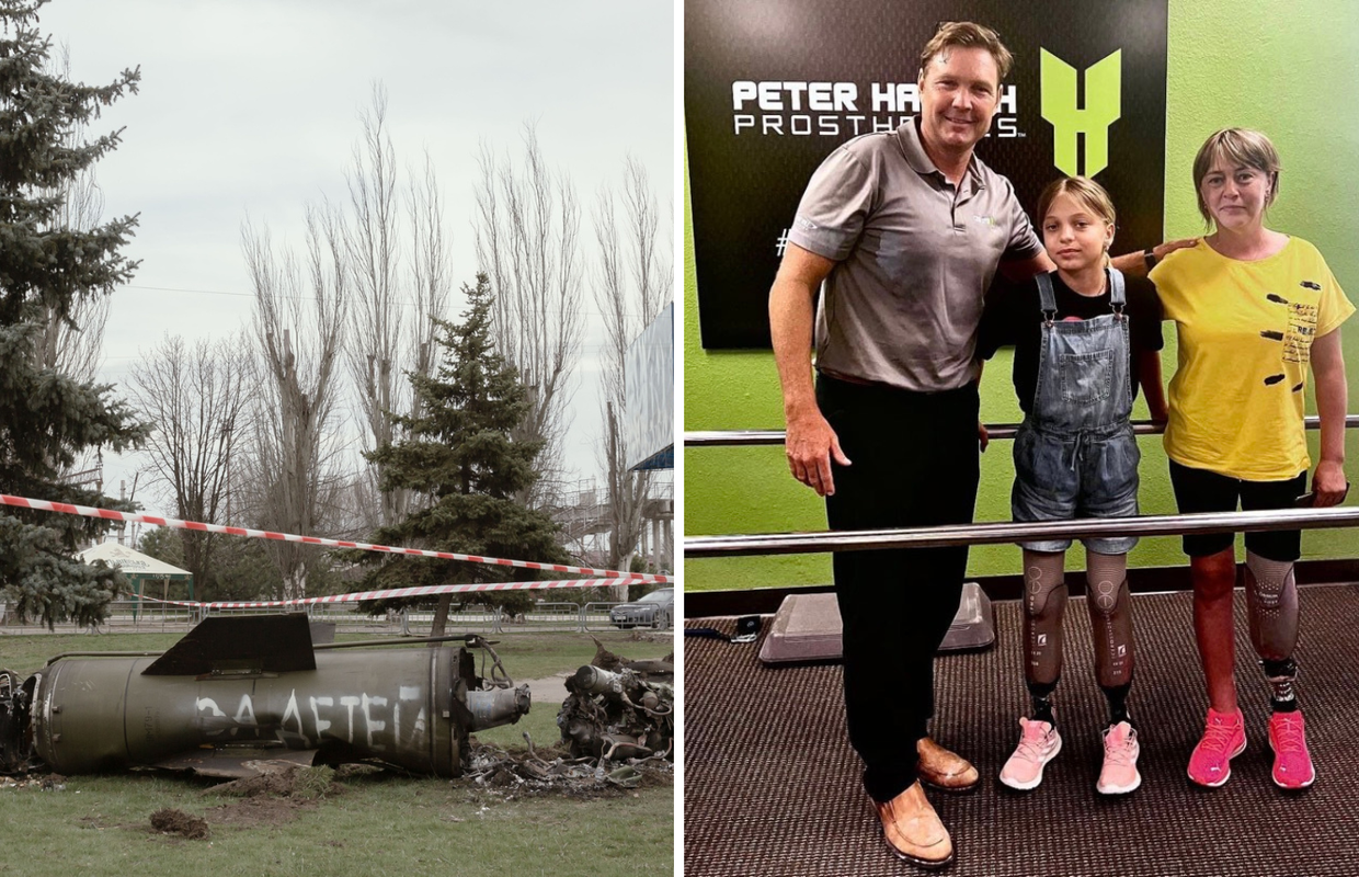 Izgubile noge u ruskom napadu: 'Pogledajte curicu koja je prošla pakao, ima priliku za novi život'