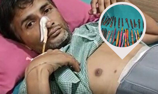 Očajni Indijac gutao je četkice i žlice na odvikavanju?! 'Ma, nisu mi davali hranu, ogladnio sam'