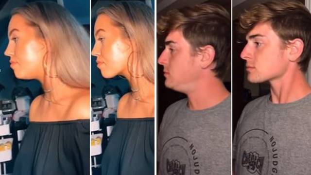 Trik kako sakriti podbradak na fotkama u sekundi - mnoge poznate face ga redovito koriste
