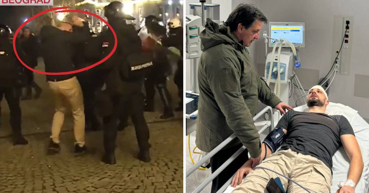 Minister Visits Injured Policeman in Hospital After Colleague’s Inadvertent Hit – Caught on Video