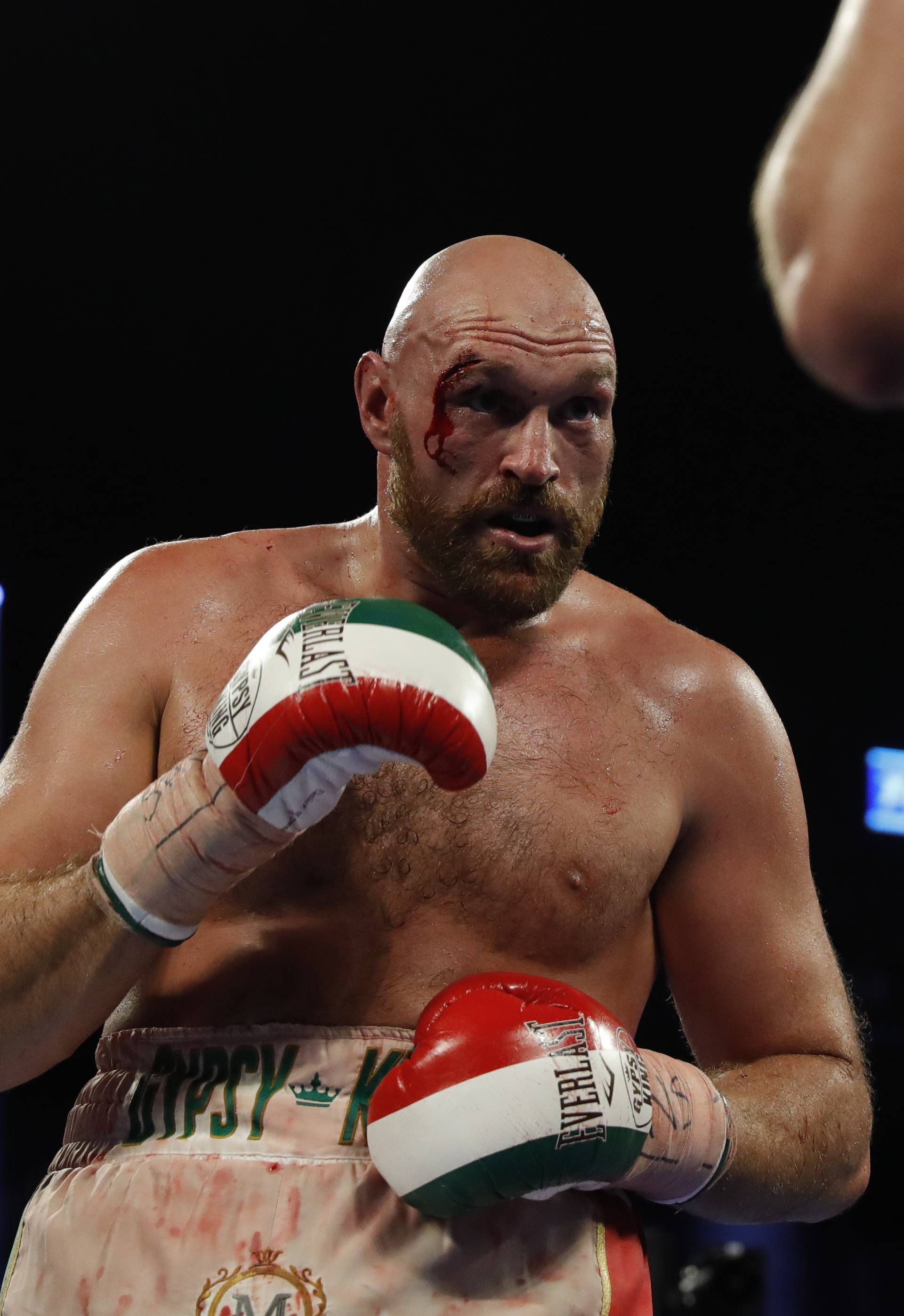 Tyson Fury v Otto Wallin