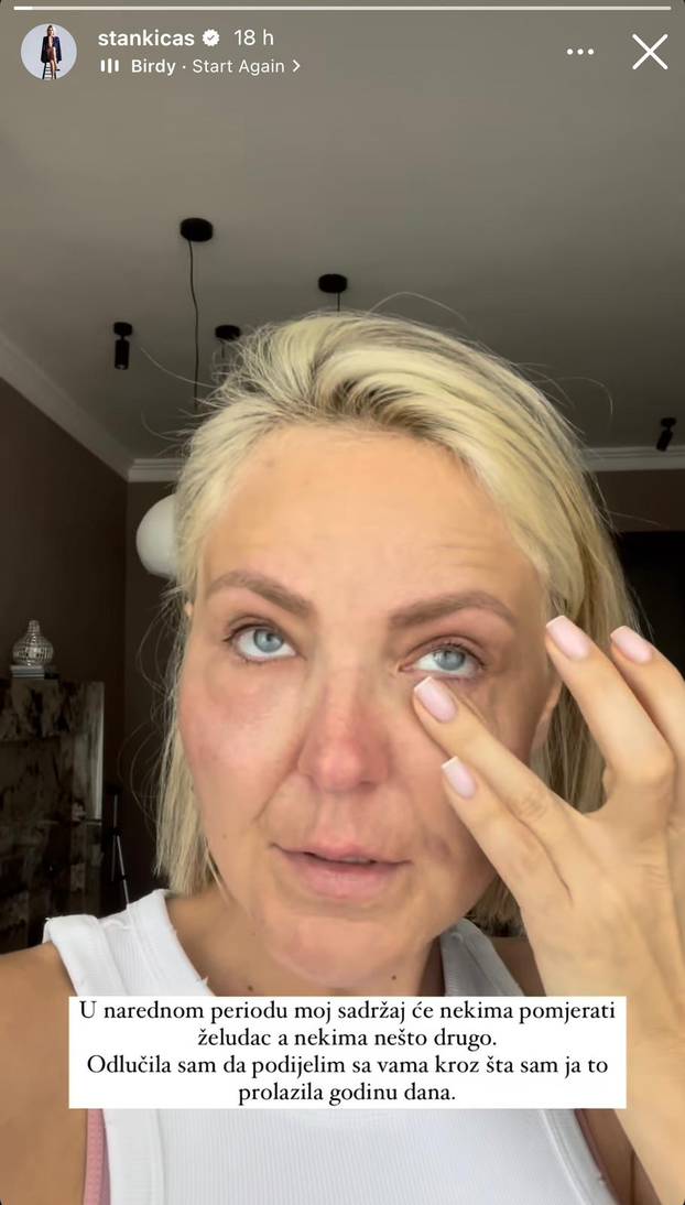 Lice su joj uništili, život joj je bio pakao, a sad je jača no ikad: Ovako danas izgleda Stankica
