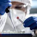 U Međimurskoj županiji danas 92 nova slučaja koronavirusa