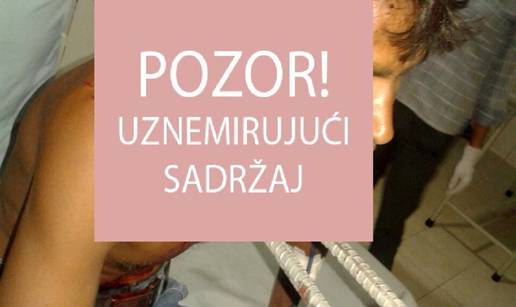 Šipke mu probile vrat i leđa: "Preplavio me osjećaj smrti..."