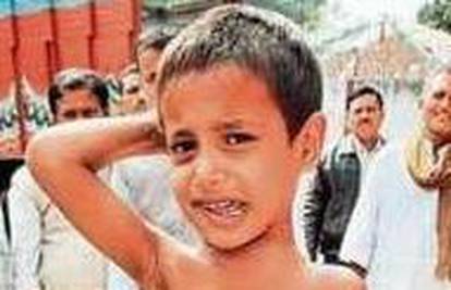 Indija: Dječak (8) u svom trbuhu nosi brata blizanca