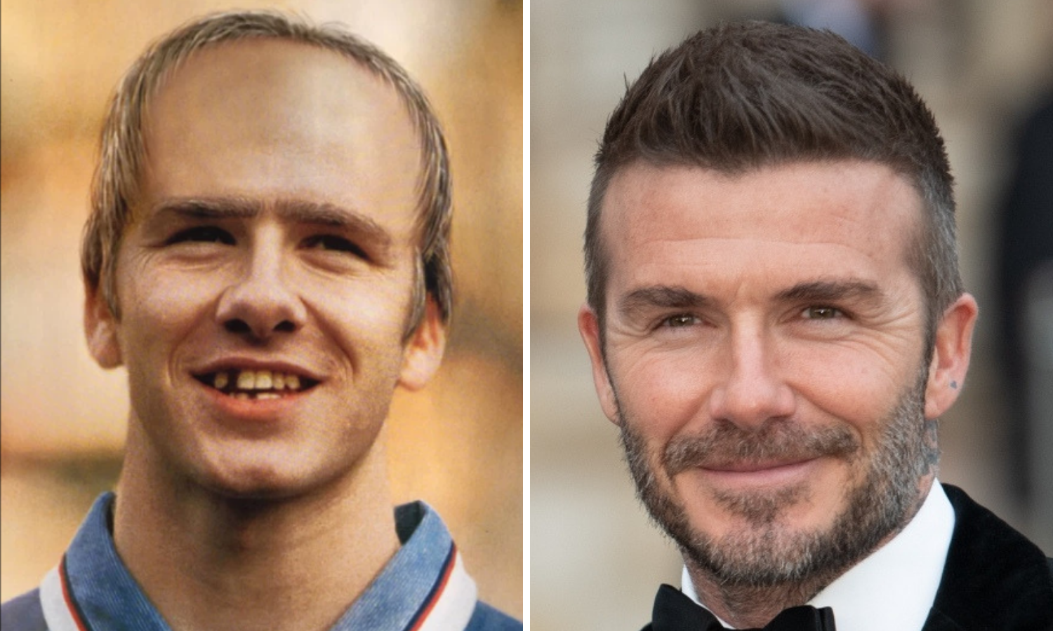 Beckhamu su 1998. predvidjeli da će postati krezub i proćelav