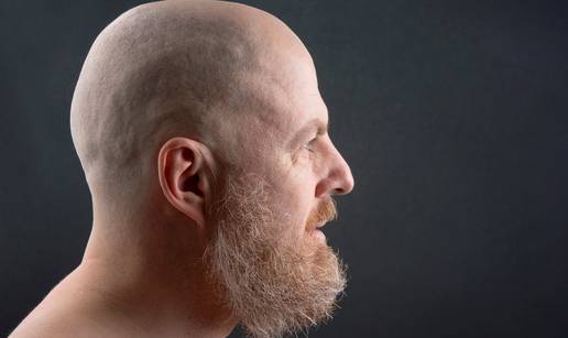 Evo s čime ćelavi ljudi trebaju prati glavu i njegovati vlasište