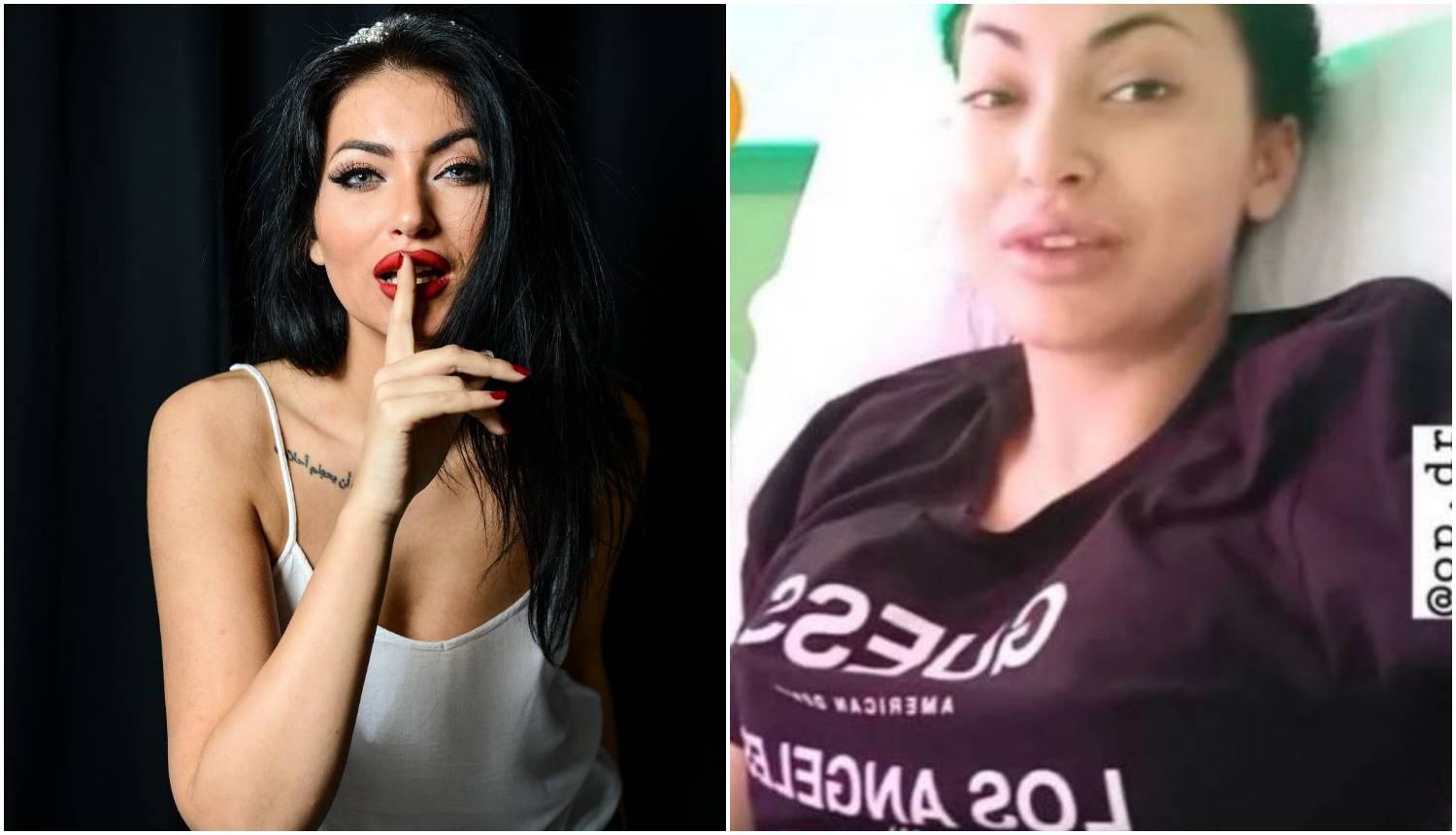 Hana Rodić poslije operacije grudi: 'Jedna mi je bila manja'