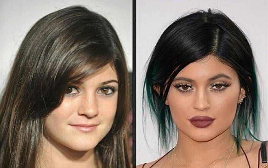 Hvala plastičaru: Ovako su ove zvijezde izgledale prije zahvata