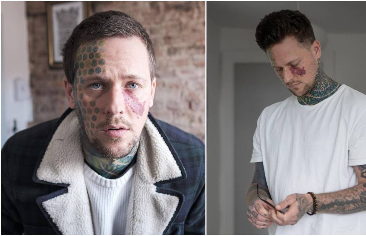 Zbog urođenog madeža na licu borio se s mentalnim zdravljem, a onda je otkrio čari tetoviranja