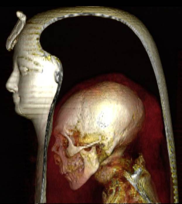 CT scanning unpeels the wrappings of a 3,500 year-old mummy with stunning results