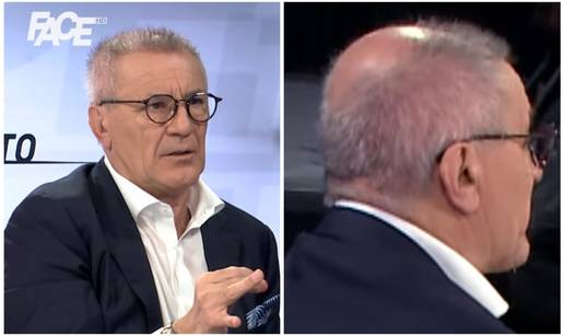 'Zdravko je&zcaron;i&cacute;': 'Bio na bolnoj transplantaciji kose i jo&scaron; se nije primilo na svim dijelovima'